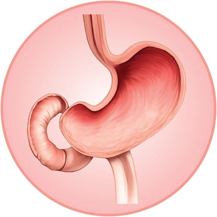 Stomach & Duodenum